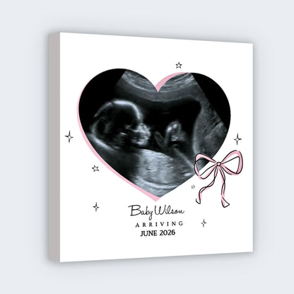 Personalized Baby Ultrasound Photo Square Canvas - Custom Nursery Wall Art Gift