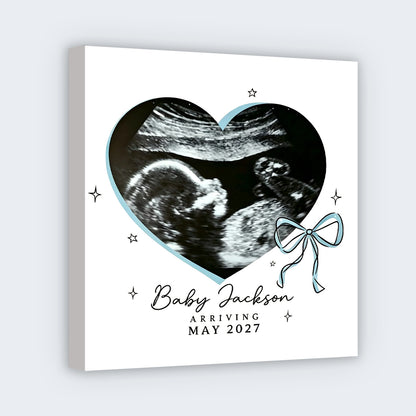 Personalized Baby Ultrasound Photo Square Canvas - Custom Nursery Wall Art Gift