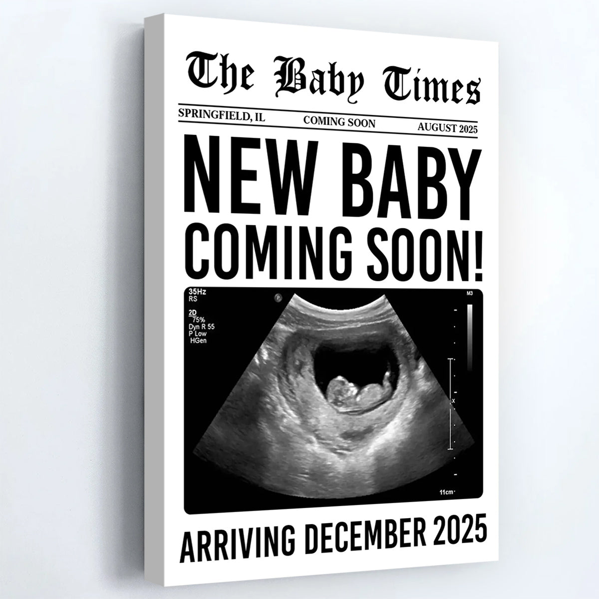 New Baby Coming Soon - Personalized Custom Ultrasound Image Canvas / Poster