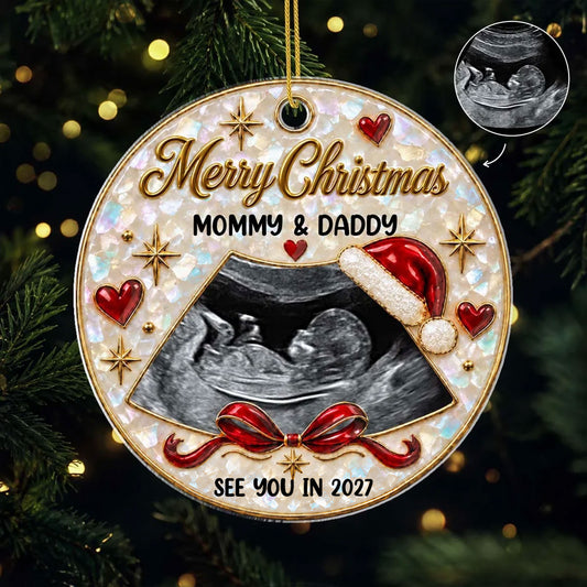 Personalized Ultrasound Christmas Ornament - Custom Baby’s First Christmas Acrylic Keepsake Gift for Expecting Parents