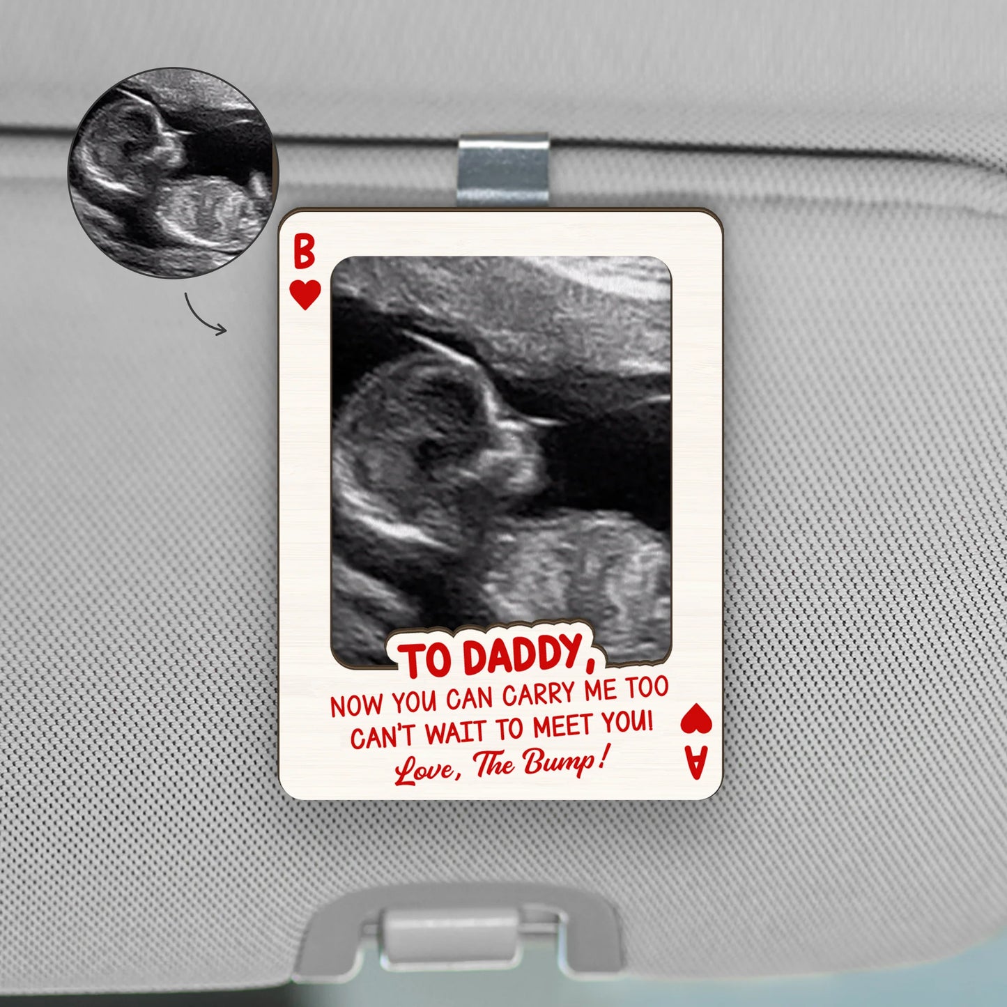 Custom ultrasound car visor clip with baby picture print and quote for expecting mom and dad