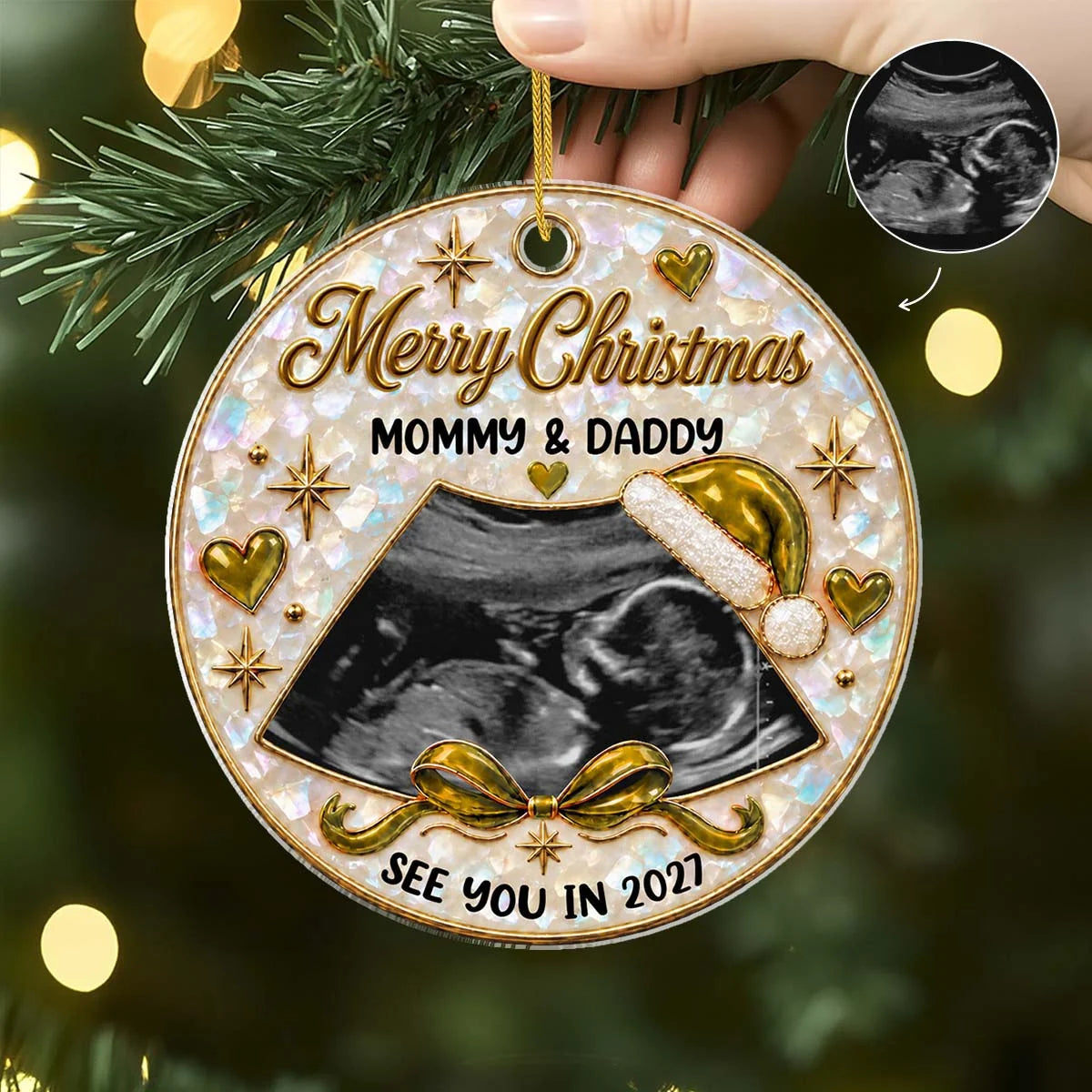 Personalized Ultrasound Christmas Ornament - Custom Baby’s First Christmas Acrylic Keepsake Gift for Expecting Parents