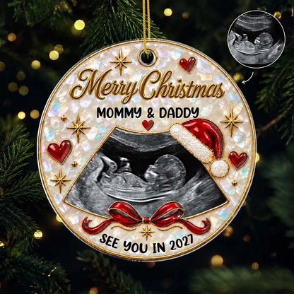Personalized Ultrasound Christmas Ornament - Custom Baby’s First Christmas Acrylic Keepsake Gift for Expecting Parents
